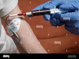 Drawing Blood From A Picc Line With Surgical Gloves (Peripherally Inserted  Central Catheter Stock Photo - Alamy
