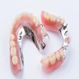 Removable Partial Denture Treatment product image