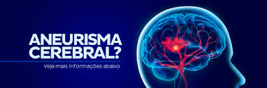 Otros tipos de aneurismas cerebrales implican un ensanchamiento de todo un vaso sanguíneo. Aneurisma Cerebral Clinica Neuro Conceito