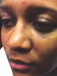 Jailing Princola Shields: A hopeless ending for a mentally ill Indiana  teenager