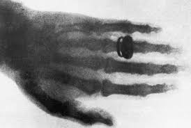 In 1895 Wilhelm Roentgen A Professor Of Physics In Worzburg Bavaria Was The First To Find A Way To Peer Inside The Body Wit Fun Facts X Ray Wilhelm Rontgen