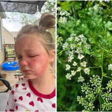 Are asparagus lookalikes poisonous or toxic?