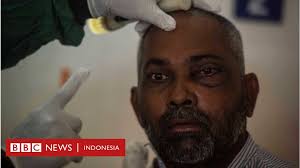 We did not find results for: Covid Di India Diperparah Penyakit Jamur Putih Infeksi Kebal Obat Yang Mengancam Nyawa Pasien Bbc News Indonesia