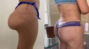 Maybe you would like to learn more about one of these? Video Asi Se Ve La Cola De Yina Calderon Luego De Su Ultima Cirugia Kienyke