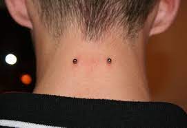 Do not touch the piercings with dirty hands. Nape Piercing Wikipedia