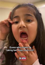 Removing a Toddler's Loose Tooth with Family Support
