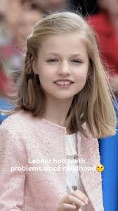 What Happened to Princess Lenor of Spain Teeth