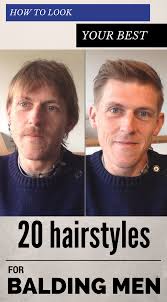 How To Look Your Best 20 Hairstyles For Balding Men Balding Mens Hairstyles Mens Haircuts Thin Hair Hair Loss Men