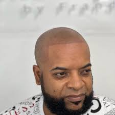 TOP 10 BEST Hair Loss Specialist near Allapattah, Miami, FL