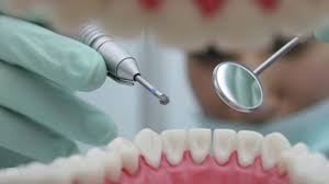 Learn about how porcelain veneers, cosmetic coverings for the front of your teeth, are installed, and how to care for them. Interesting Facts About Teeth And Dentistry Comfort Care Family Dental P C