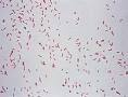 Image result for mycobacterium phlei schizophrenia