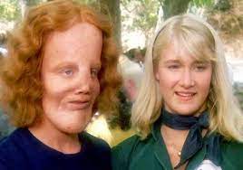 Rocky Dennis : r/nostalgia