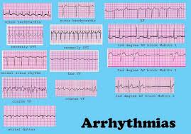 Search Page Nurse Cardiac Nursing Nursing Notes