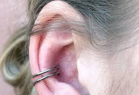 An infected cartilage piercing may have a bump, abscess or even drain pus. How Bad Do Conch Piercings Hurt