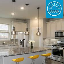 After choosing a plan, you'll have the option to configure your tv equipment, dvr service and channel packs. 6 Pack 6 Inch 3cct Ultra Thin Led Recessed Ceiling Light With Junction Box 3000k 4000k 5000k Selectable 15w Eqv 150w 1400lm High Brightness Dimmable Canless Downlight Slim Recessed Lighting Amazon Com