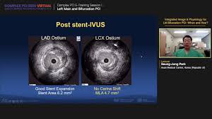 Doanh nghiệp fdi tiếp tục coi việt nam là điểm đến đầu tư hấp dẫn. Complex Pci 2020 E Training Session I Left Main And Bifurcation Pci Youtube