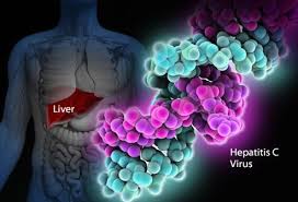 Chronic hcv infection can progress to severe liver disease including cirrhosis and hepatocellular carcinoma. 19 Hepatitis C Symptoms And Transmission Treatment Information