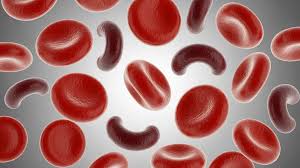Image result for Anemia