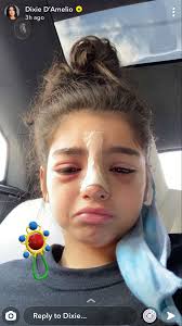 Pin By Addie Yuh On Dixie Damelio In 2020 Dixie The Most Beautiful Girl Carnival Face Paint