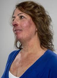 the Walls From Closing In