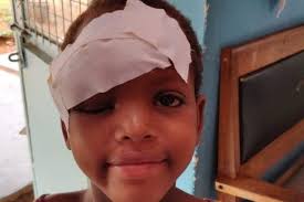 Fundraiser by David Williams : Royjan's Legacy (James Ashe Antivenom Trust)