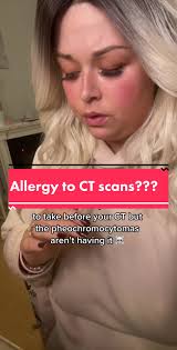 If you've had a CT with contrast and you have #anaphylactic TYPE sympt...