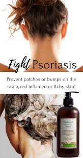 Fight Psoriasis Soften Hair Hair Shampoo Skin Care Face Cream