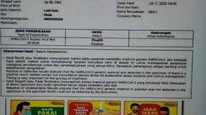 Viral Surat Hasil Swab Test Atas Nama Rizieq Shihab Positif Covid 19 Mer C Itu Bukan Dari Kami Tribun Palu