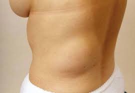 Pin Di Natural Health