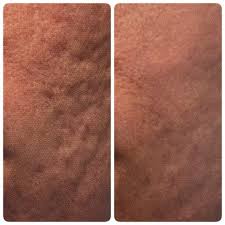 Call now · more info. Lucy Peters Aesthetic Center Home Facebook