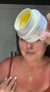 What's good for sunburn please