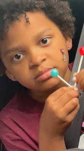 My daughter has orbital cellulitis.