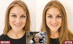 Big Brother S Nikki Grahame Reveals She Has Hair Pulling Condition Hair Pulling Hair Nikki