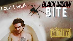 The black widow bite spider is undoubtedly the most toxic species of the creature. Black Widow Bite Try To Survive Youtube