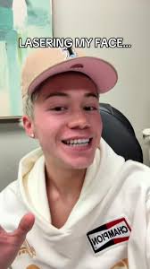 Facial Hair Removal Experience with Laser Treatment