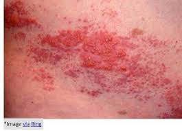 Pin On Skin Care