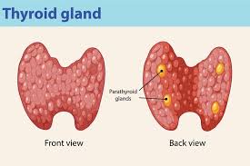 Image result for Hyperparathyroidism