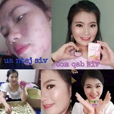 ໂອໂຫໃຊ້ດີຈີງໆ ບີແມຄີມຊ່ວຍລົດສີວລົດຟ້າໄດ້ດີມາກ ລີວີວຈາກຄົນໃຊ້😱😮😮📍📍  ຫນ້າມີສີວມີຟ້າແບບນີ້ຕ້ອງ " ບີແມຄີມ " ຜູ້ຊ່ວຍ ຮັບຕົວແທນຂາຍນຳ