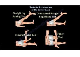 Image result for Low Back Standing Exam