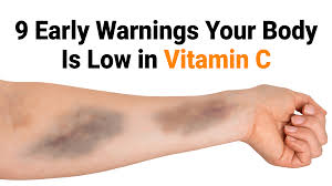 That said, there is still probably a bit about vitamin c that you might not know. 9 Early Warnings Your Body Is Low In Vitamin C