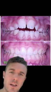 Burrow Orthodontics Reviews