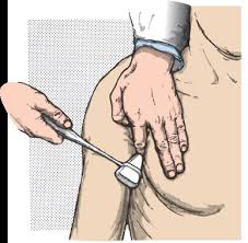 Image result for Supinator Reflex