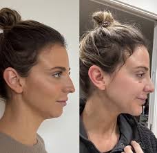 Before and after? : r/DaniAustin