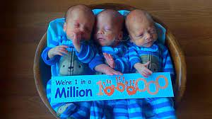 By unbelievable facts aug 28, 2020, 11:40 pm comments off on the story of identical triplets who were separated at birth in the name of a cruel science experiment One In A Million Identical Triplets Close To Returning Home Abc News