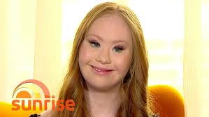 Model With Down Syndrome Madeline Stuart Makes Her New York Fashion Week  Debut