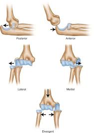 Image result for Elbow Dislocation