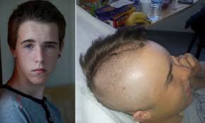 Thug aged just 12 who battered teenager with iron bar given just 3 months  probation