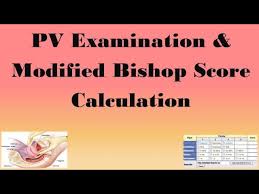 Image result for Bishop Score