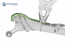 Operation Video of Cable Plate System
