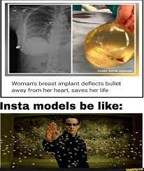 Breast implants meme